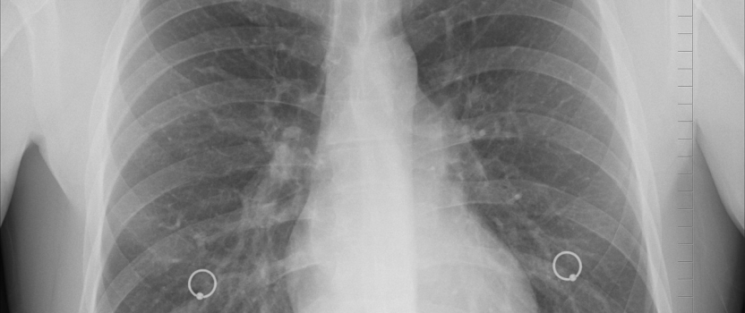 South Carolina Patent of the Month – December 2025